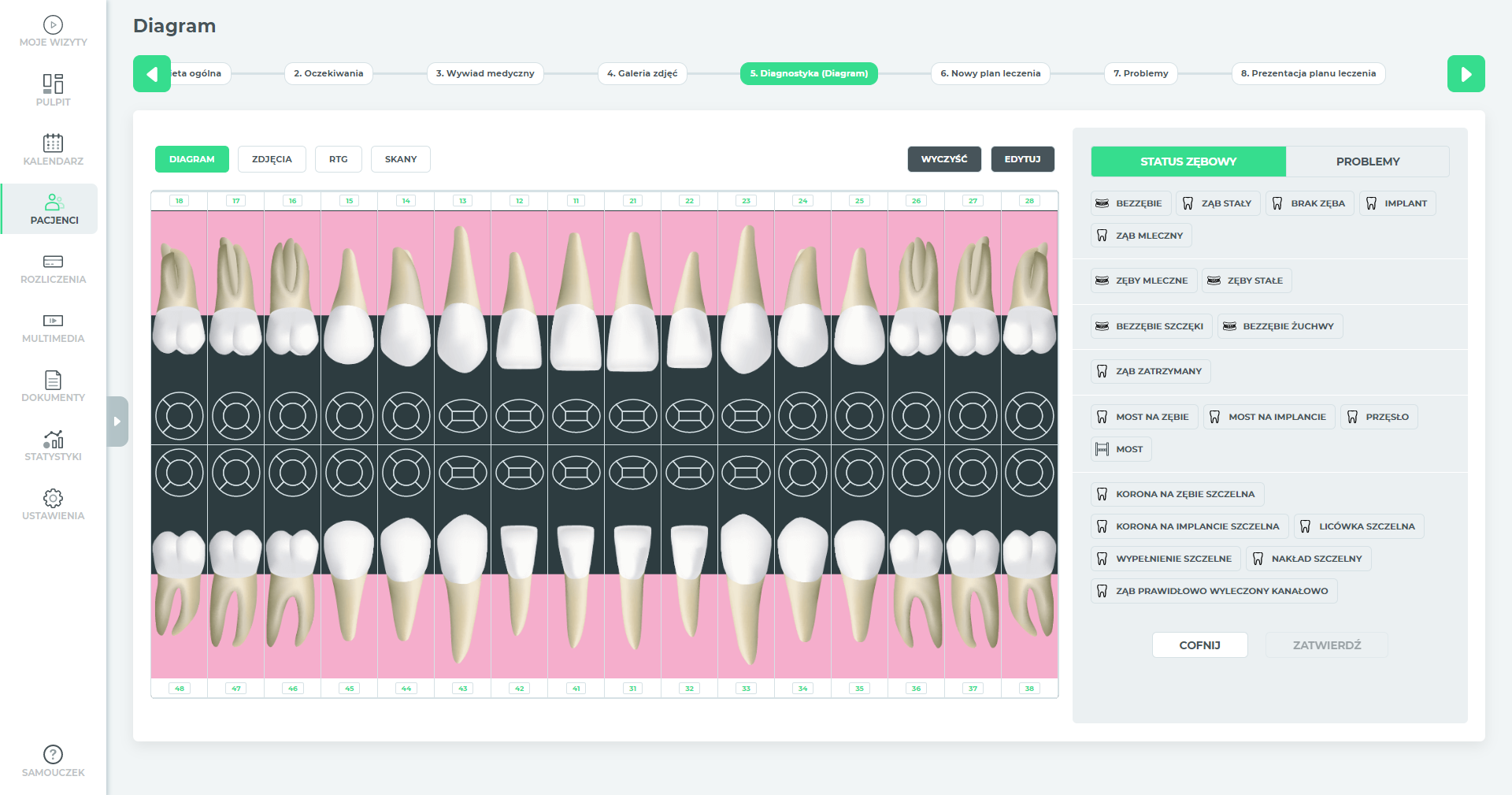 IQ Dental - Zwiększenie diagramu na karcie pacjenta
