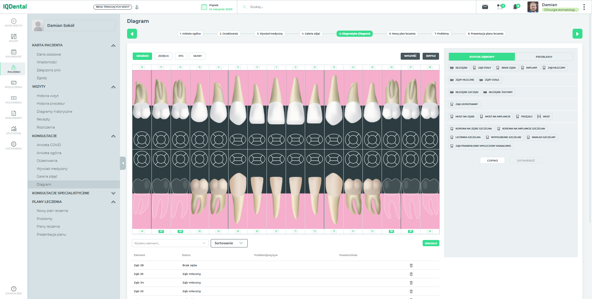 IQ Dental - Zmiana koloru zębów mlecznych